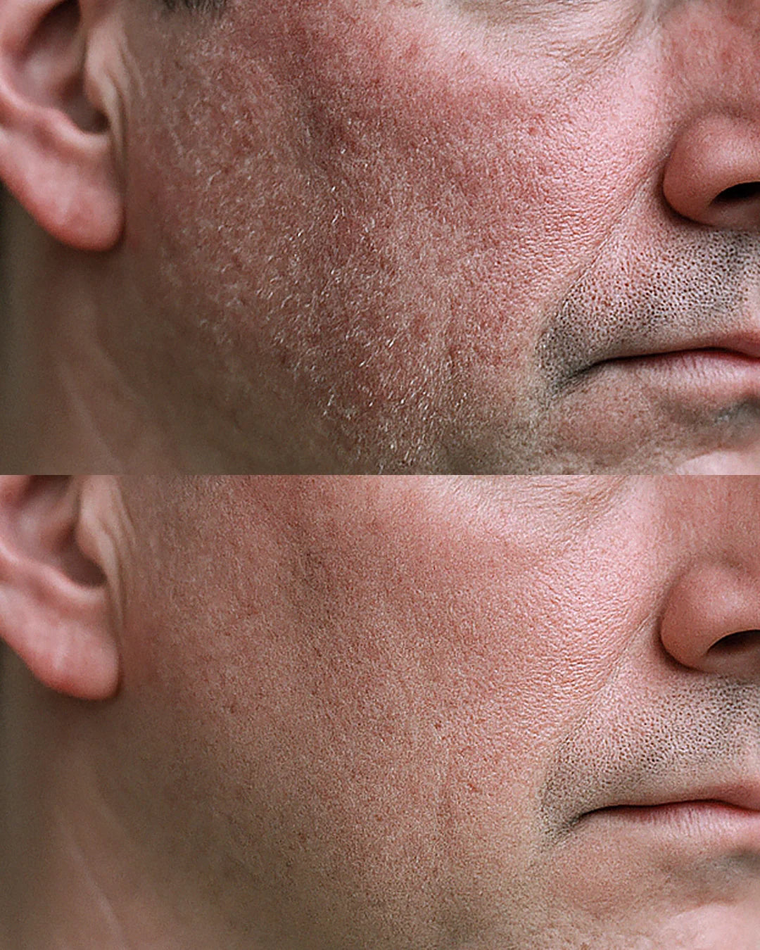 43 Anti-Aging Shaving Gel