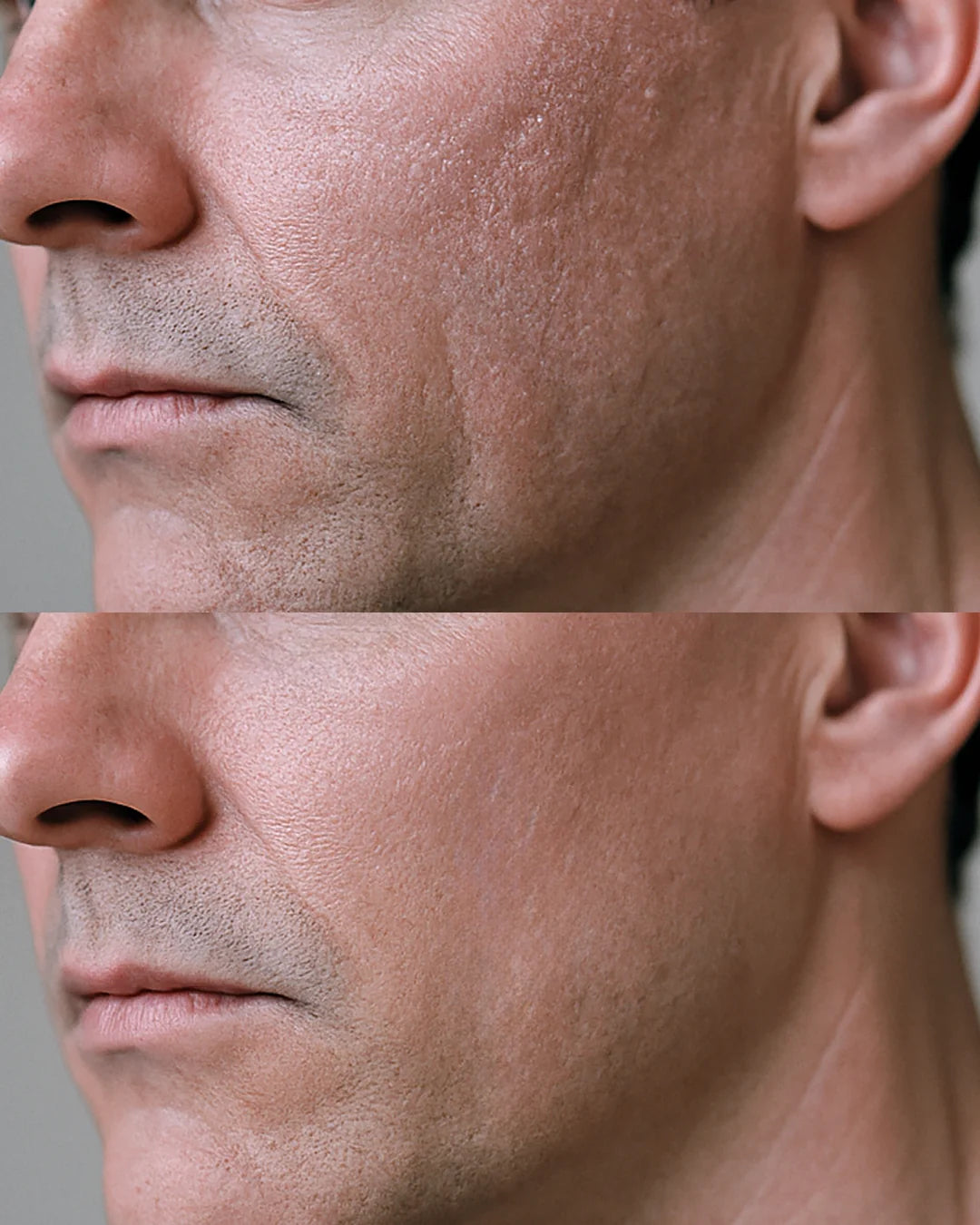 43 Anti-Aging Shaving Gel